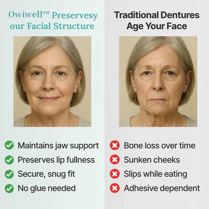 ✨Ends Today: 70% OFF! Owiwell™⏰ Custom-Fit Full Functional Dentures Make you more confident