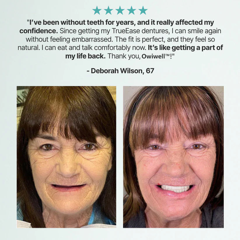 ✨Ends Today: 70% OFF! Owiwell™⏰ Custom-Fit Full Functional Dentures Make you more confident